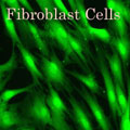 Fibroblasts